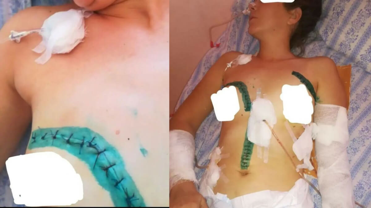 Алматы облысында ер адам бұрынғы әйелін 22 жерінен пышақтап тастаған